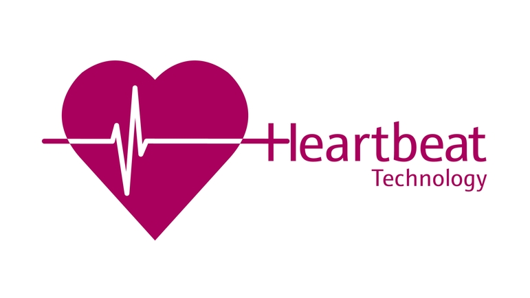 Heartbeat Teknolojisi