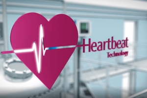 Heartbeat Teknolojisi ile akıllı enstrümantasyon